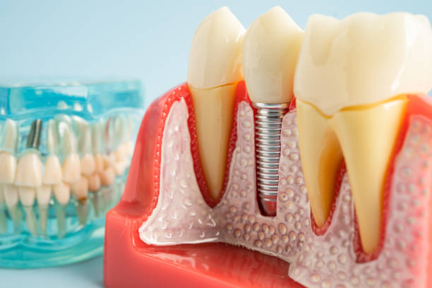 Professional  Dental Services in St Paul, MN